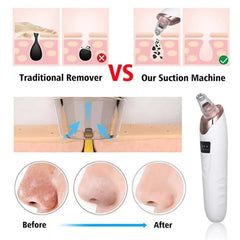 Face Vacuum Suction Blackhead Remover Pore Cleaner Electric Deep Cleansing Tool For Nose And Fac